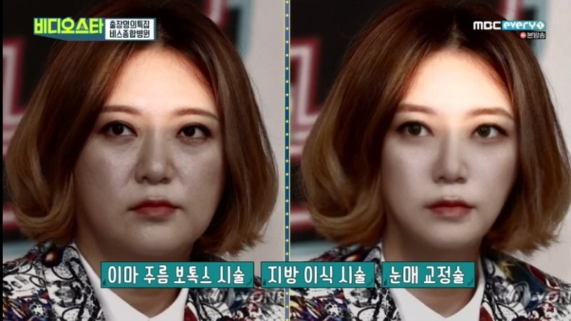 김숙가상성형, 숙이린의 탄생 스토리(?)