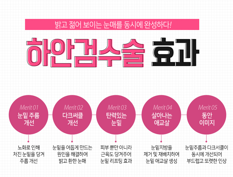 눈밑주름, 눈밑지방, 다크써클 고민, 하안검수술로 해결!