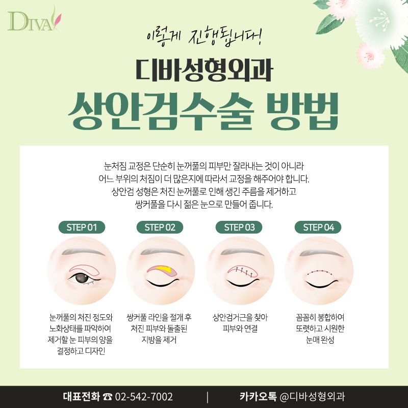 [디바성형외과]강남 상안검수술로 중년의 아름다움을