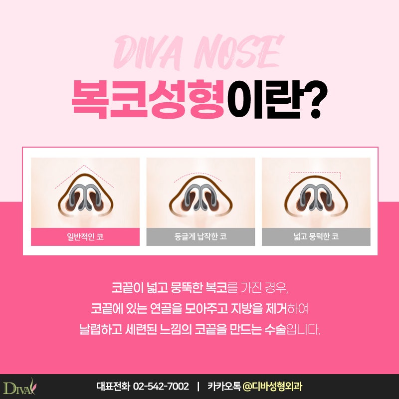 [디바성형외과] 복코성형으로 세련미 넘치게