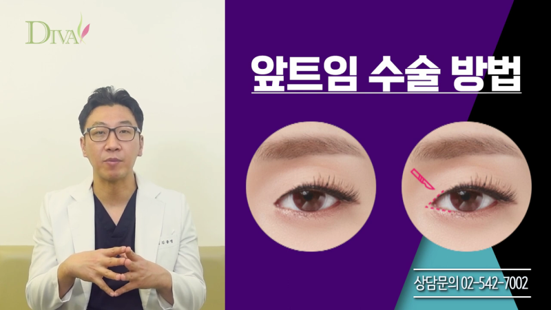중년눈매교정 필요한 이유는