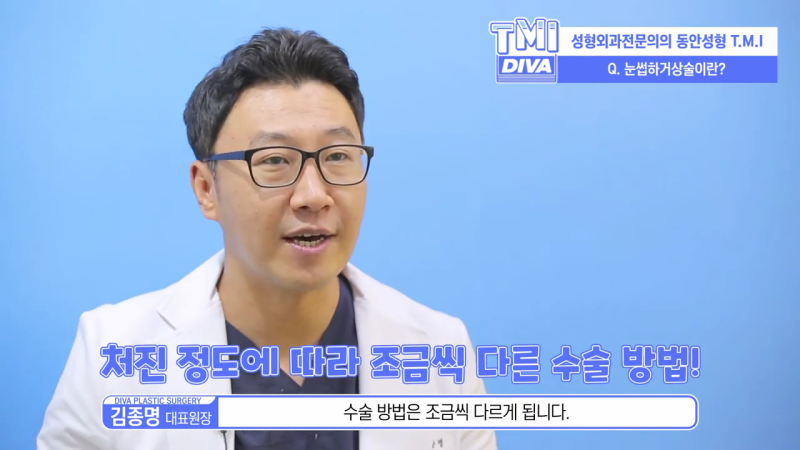 상안검수술회복기간 탄력있는 눈매는