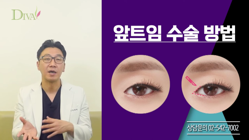 뒷트임 고민된다면