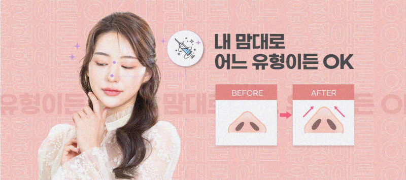 콧대수술 잘하는 병원 찾는 방법은?