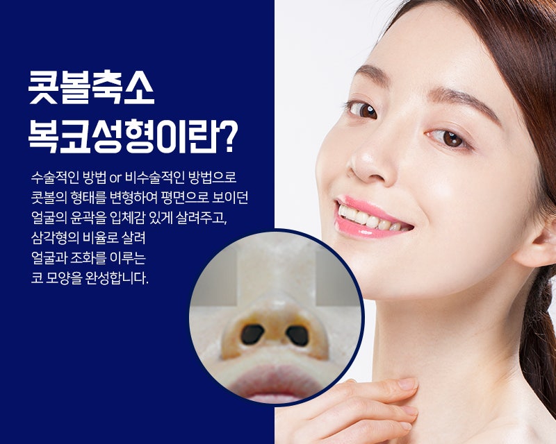 코성형 능력자가 말하는 복코 & 콧볼축소 방법은?